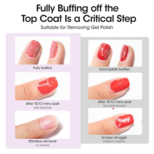 GELLEN Acetone Nail Polish Remover Pads, Professional Gel Polish Remover Pads, 200 Pack Travel Bulk Set with Tools, Individually Wrapped Quick & Effective Soak Off Remover for Salon Home