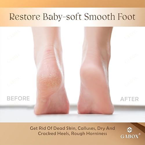 GABOX Nano Glass Pro Foot File, Feet Callus Remover, Dead Skin Exfoliator - Image 5
