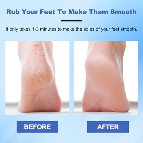 2pcs Hard Skin Remover Nano-Glass Foot File, Nano Glass Foot File - Image 3