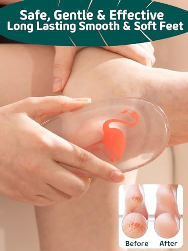 Glass Foot File Callus Remover for Feet, Flamingo Gifts for Women, Feet - Image 3
